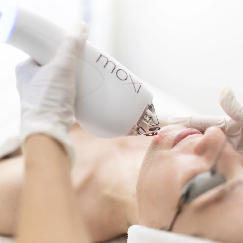 Lasers & Skin Rejuvenation Thumbnail