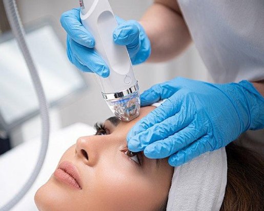 Microneedling