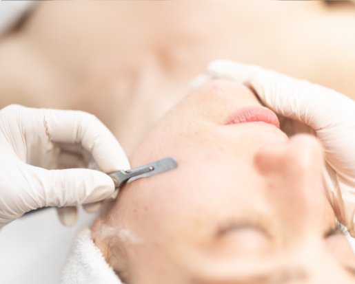microneedling-med-spa