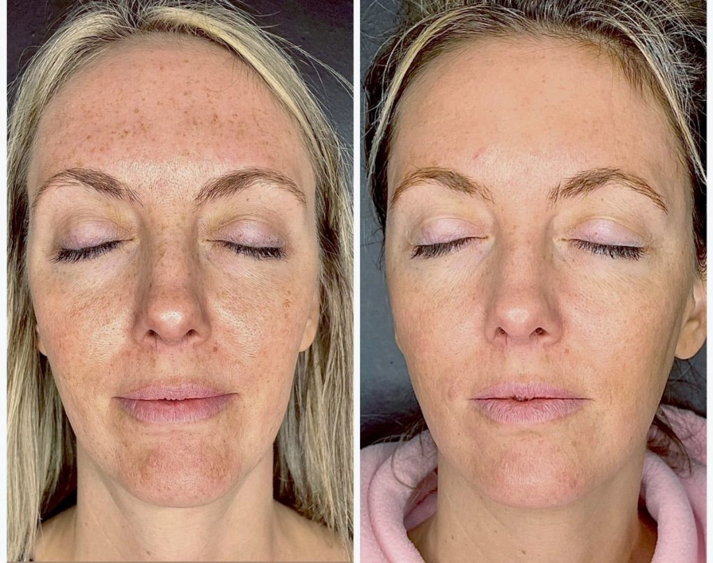 before-and-after-photo